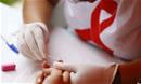 Novos casos de Aids em   idosos crescem 26% em SP